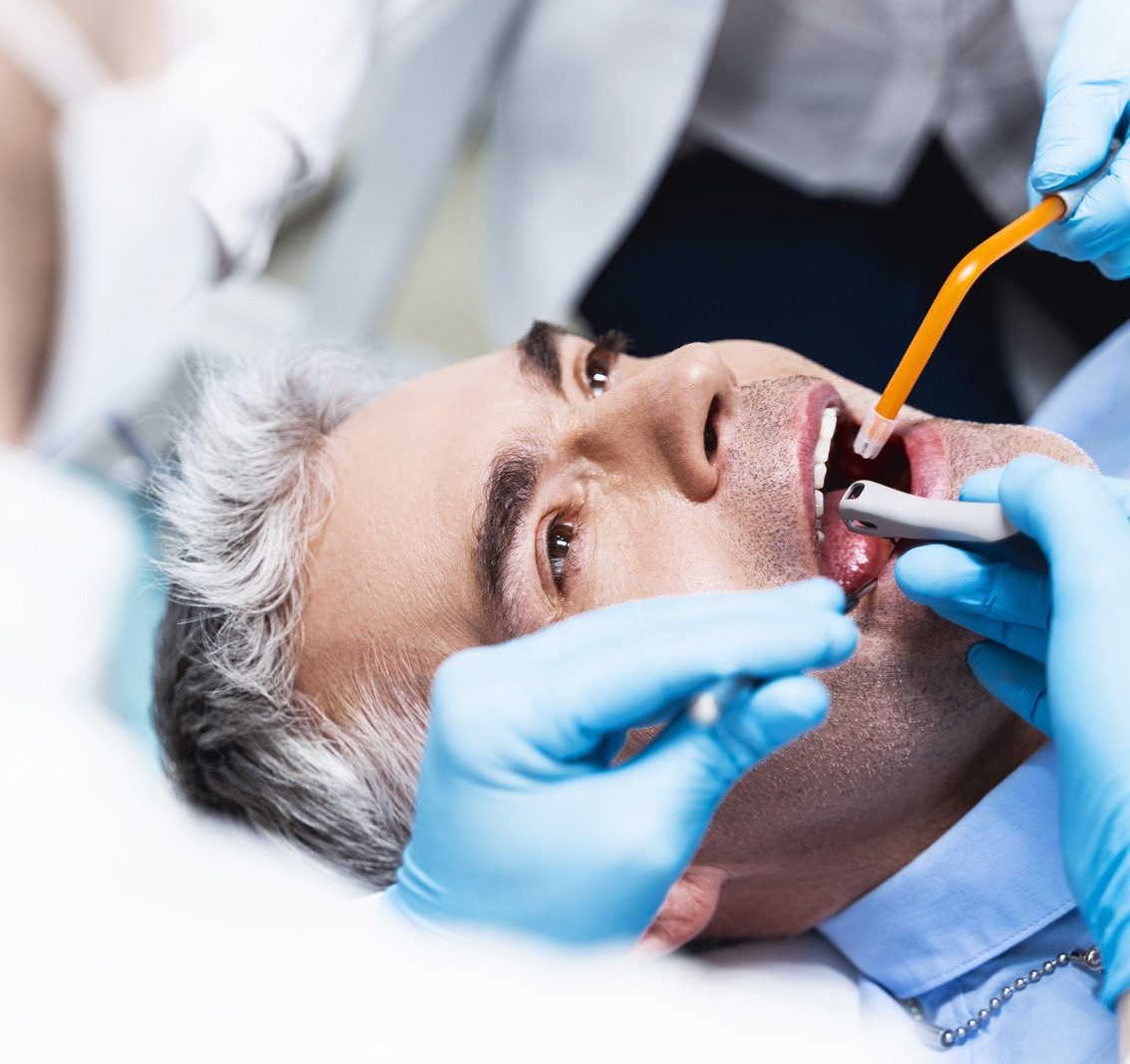 Wisdom Teeth Removal